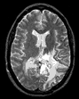 mri example